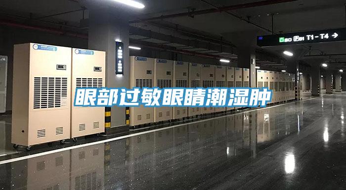 眼部過(guò)敏眼睛潮濕腫